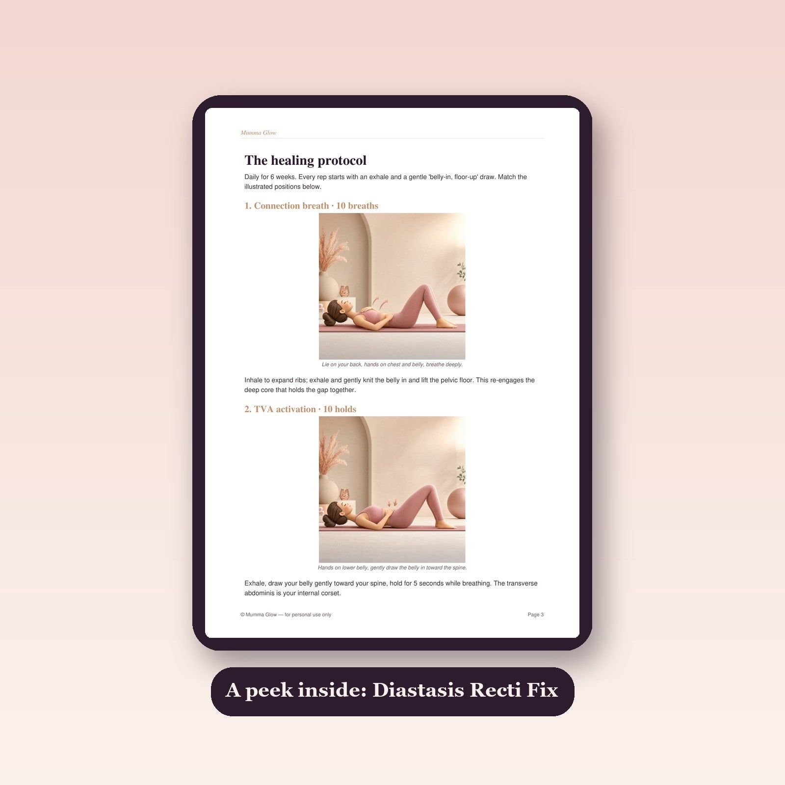 Peek inside Diastasis Recti Fix